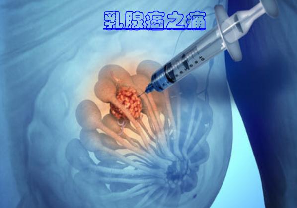 這些食物可以預(yù)防乳腺癌 ？乳腺癌手術(shù)后多久化療？