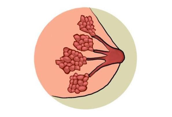 乳腺結節(jié)可以治好嗎 將切除腫塊組織病理檢查根治