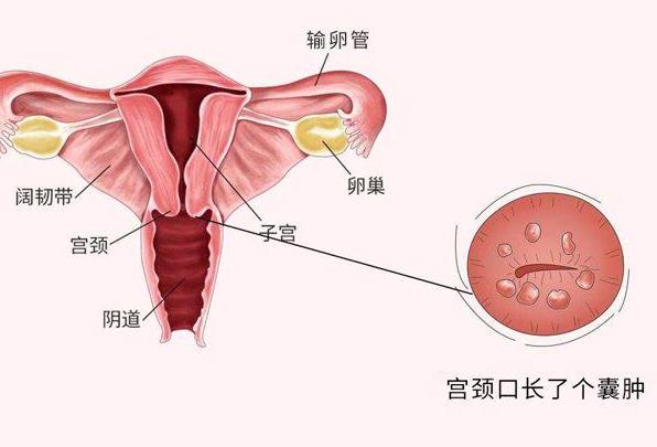 宮頸癌疫苗間隔多長時(shí)間 打人乳頭瘤疫苗注意什么